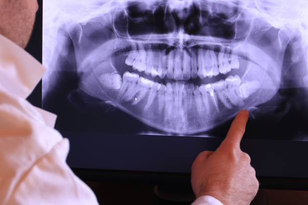 Best Emergency Dental Extractions in Jasper, TN
