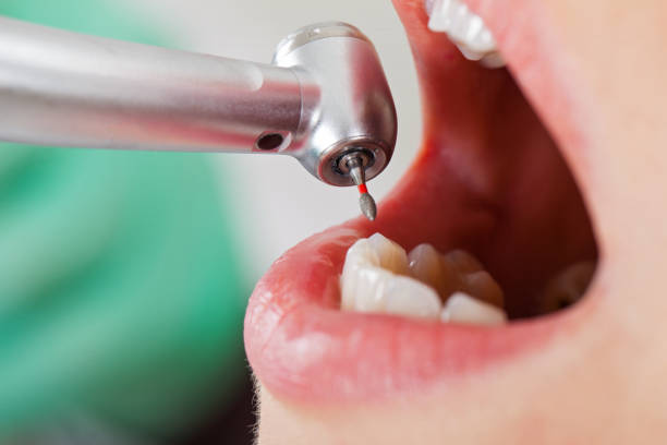 Best Broken or Cracked Tooth Emergency Dentist in Jasper, TN